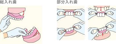 入れ歯の外し方